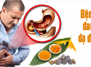 06 bài thuốc dân gian chữa bệnh dạ dày bạn không nên bỏ qua